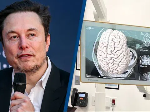 Elon Musk: Chip não của Neuralink đã được cấy vào người thử nghiệm đầu tiên